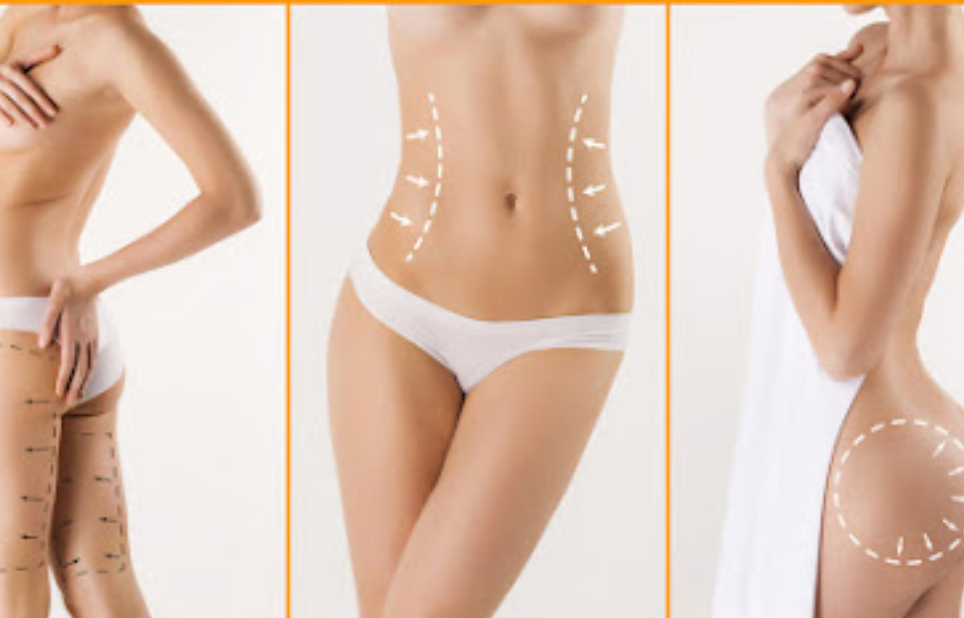 full body liposuction indore, liposuction indore, liposuction treatment in indore