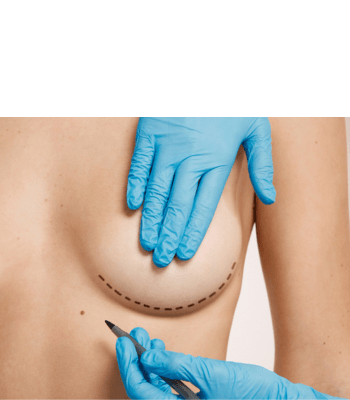 breast lift​ surgery in indore, breast specialist in indore