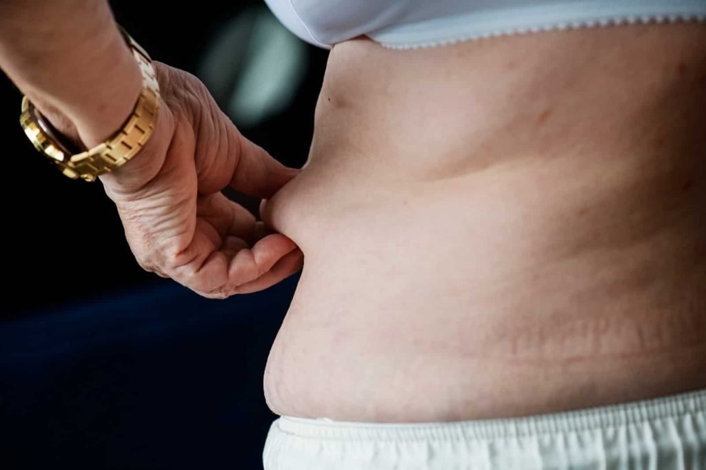 best liposuction in Indore, liposuction indore