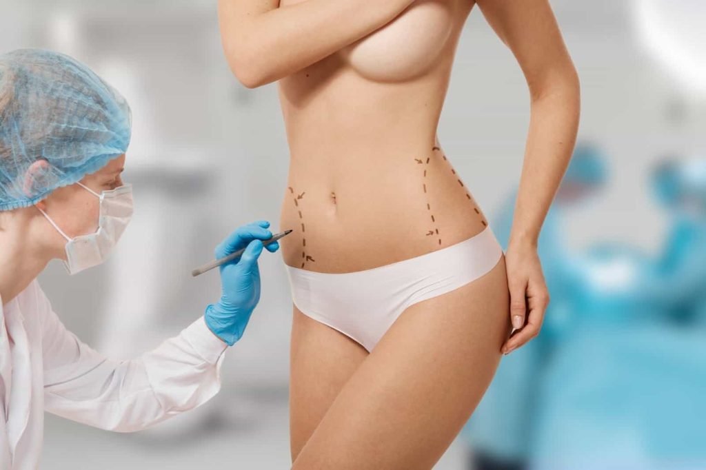liposis suregry in indore, liposuction in indore