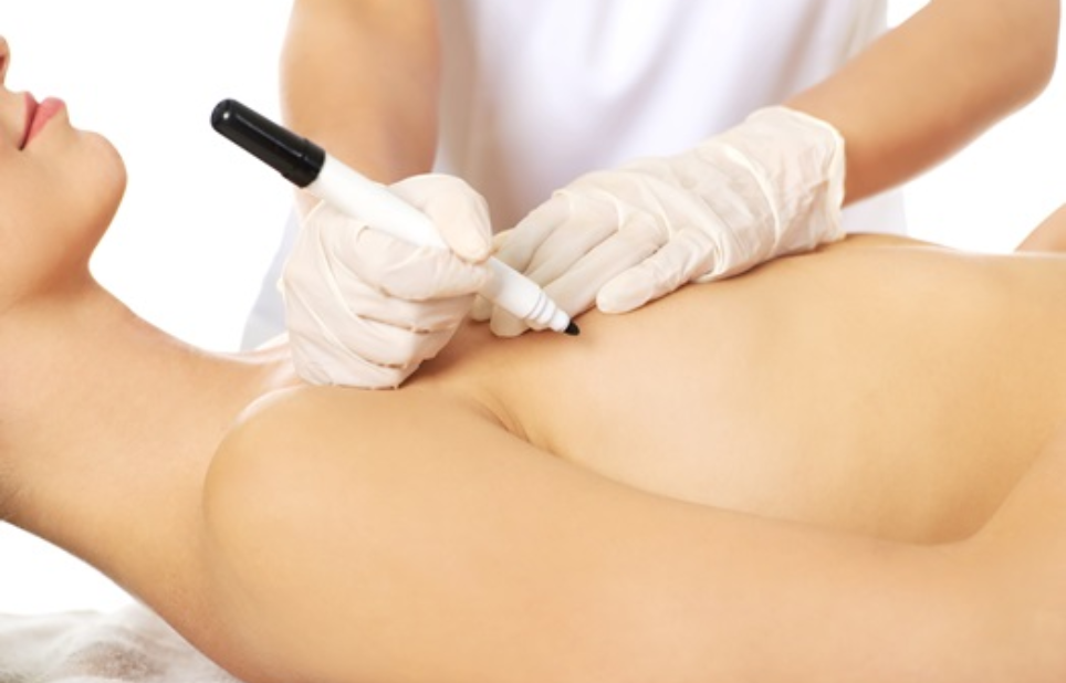 Liposuction clinic in indore, Best Lliposuction DOctor In Indore, Liposuction Treatments In Indore, Breast Surgery In INdore | Bodyshaping Clinic In Indore